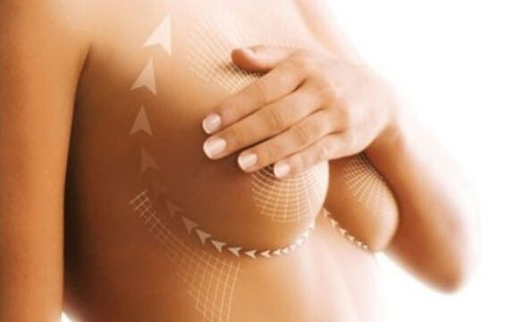 podnoszenie szwów do powiększania piersi
