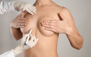 metody powiększania piersi metodą operacyjną