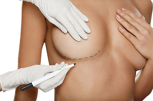 Znakowanie markerem przed zabiegiem powiększania piersi